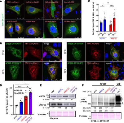 The Ubiquitin Ligase RNF34 Participates in the Peripheral Quality Control of CFTR (RNF34 Role in CFTR PeriQC)